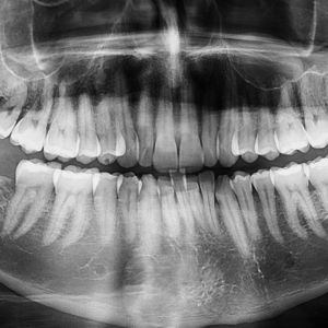 Sensational smiles x-ray