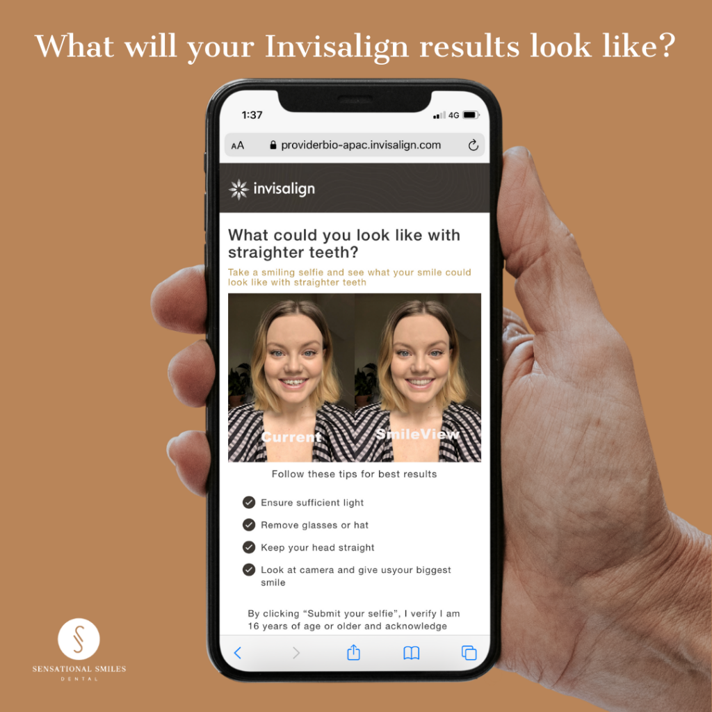 What will your invisalign results look like